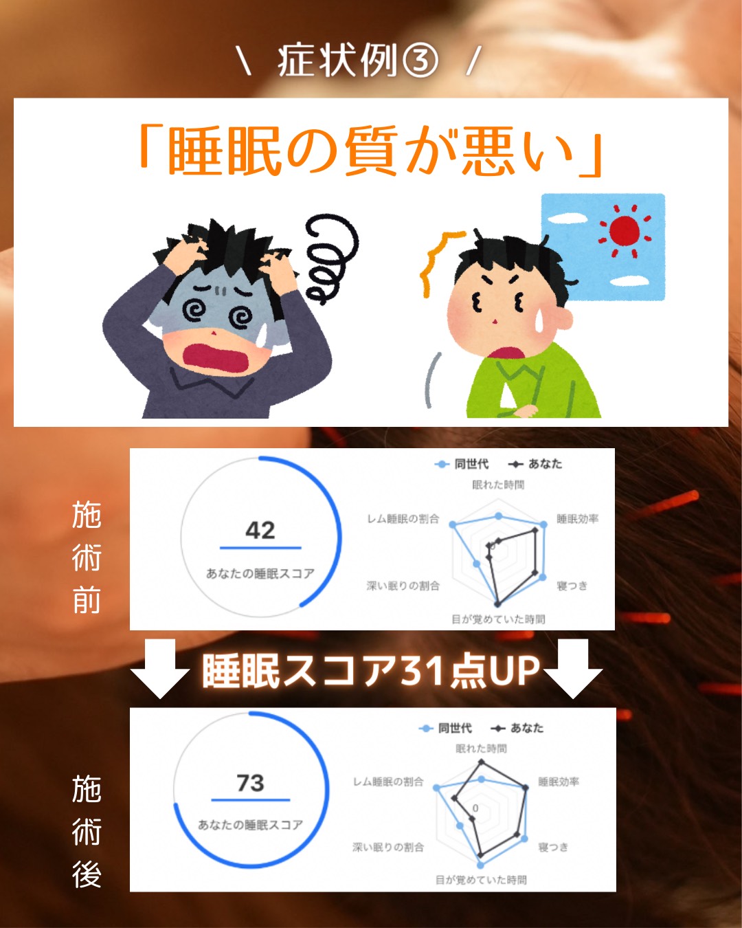 こんな症状に【あたまの鍼をした結果がやばい。】